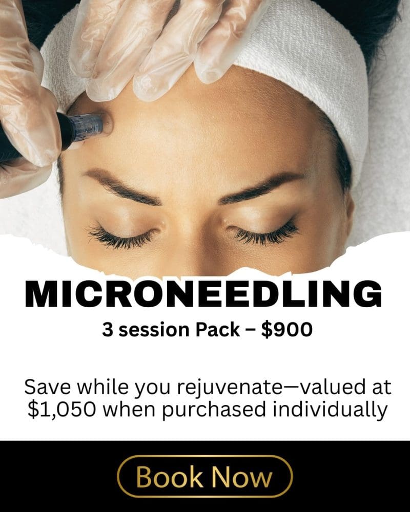 Microneedling big savings